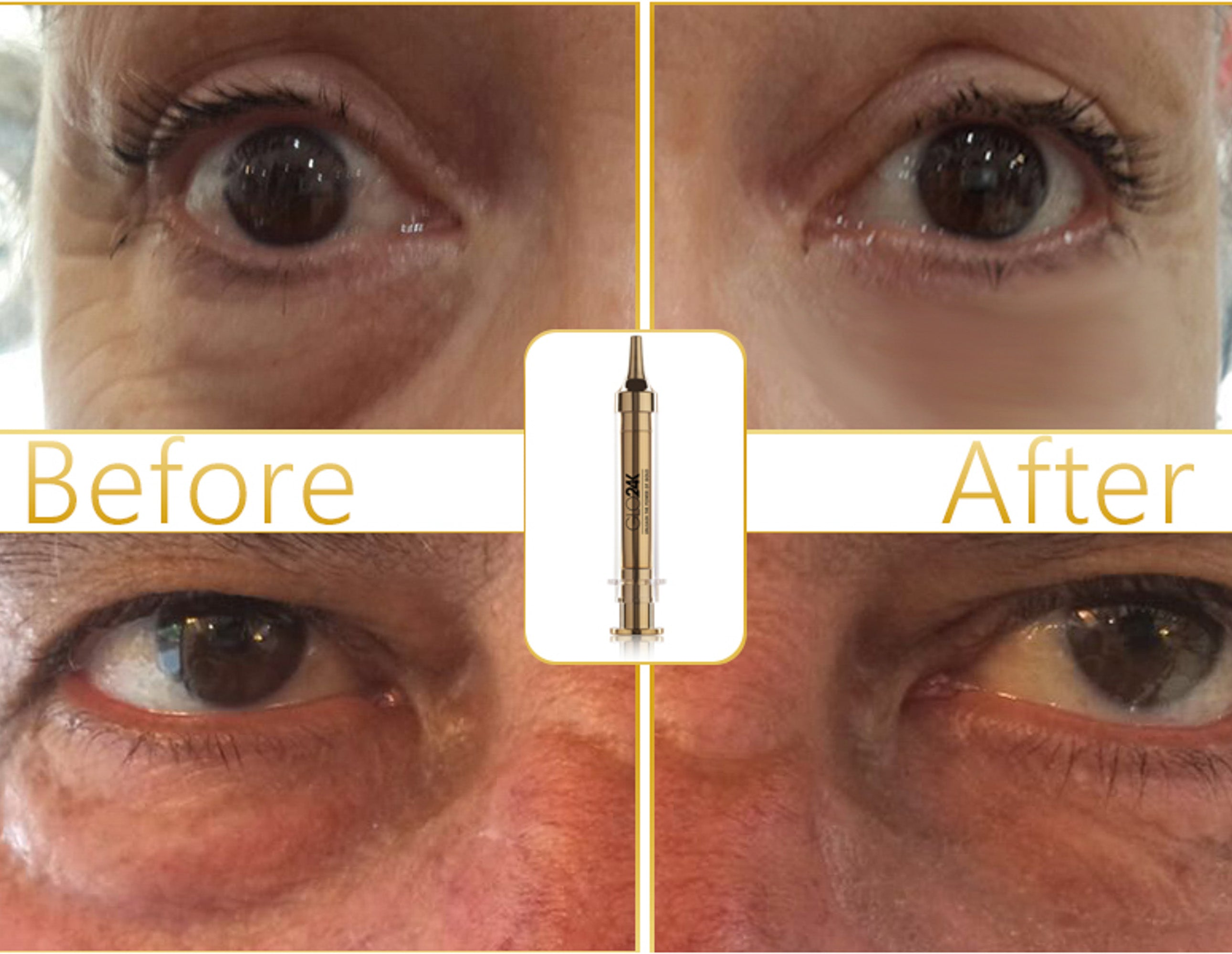 Crema facial anti-envejecimiento no quirúrgica efecto lifting con 24k de oro ácido hialurónico y vitaminas A C E para todo tipo de piel