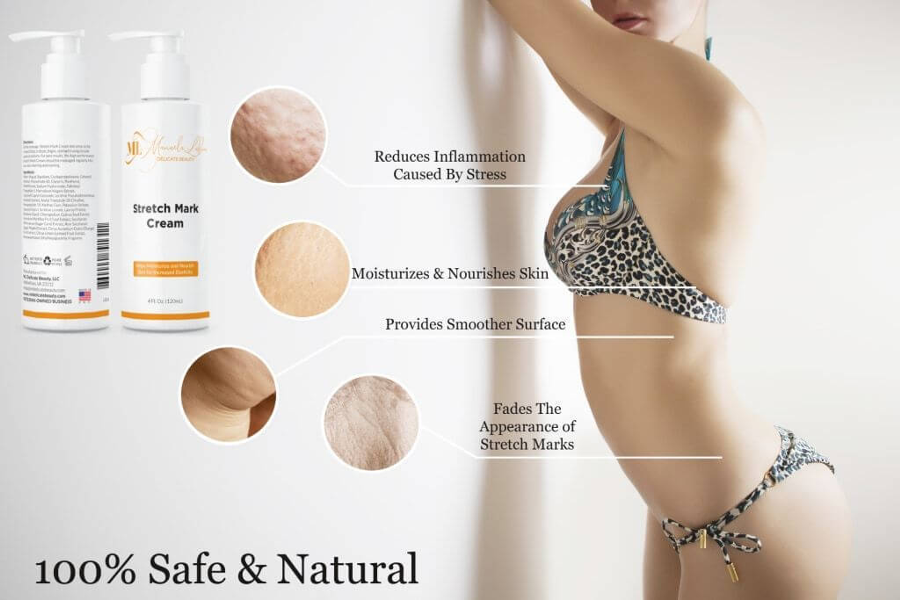 Stretch Mark Cream Skin Treatment Moisturizing Reduces Inflammation Prevents Future Marks Safe for All Skin Types