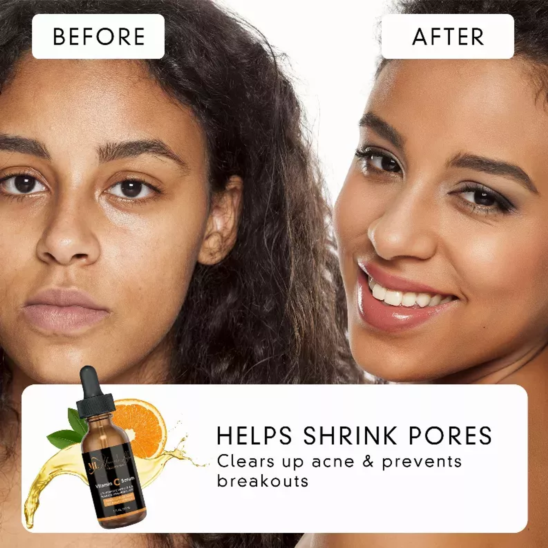 Suero facial anti-envejecimiento de vitamina C 12% con ácido hialurónico para rostro ojos cuello 24 horas de hidratación y reducción de arrugas