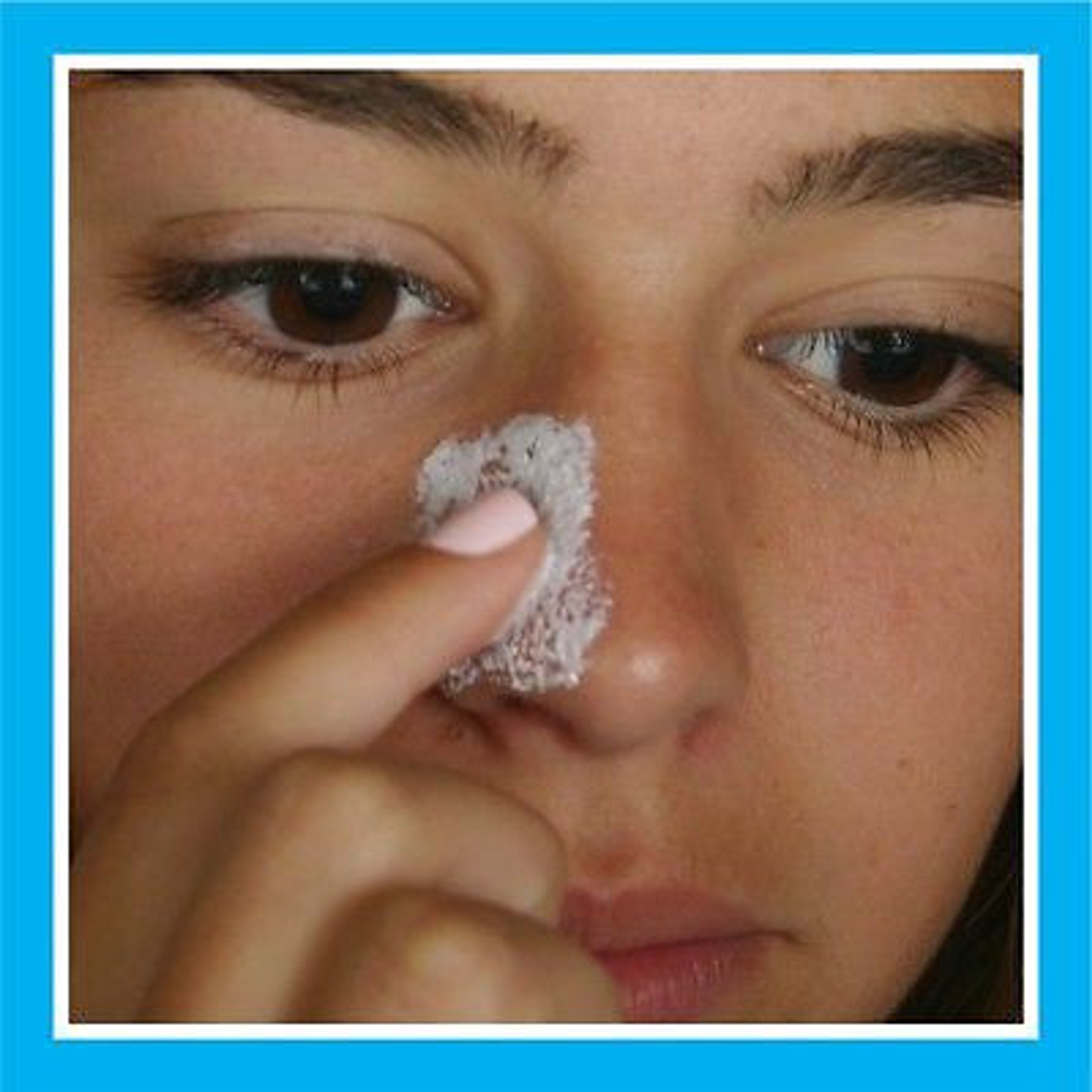 Blackhead Eliminator Deep Cleanser Unclogs Pores Removes Blackheads Whiteheads Exfoliates Skin Up to 15 Full-Face Treatments Per Kit